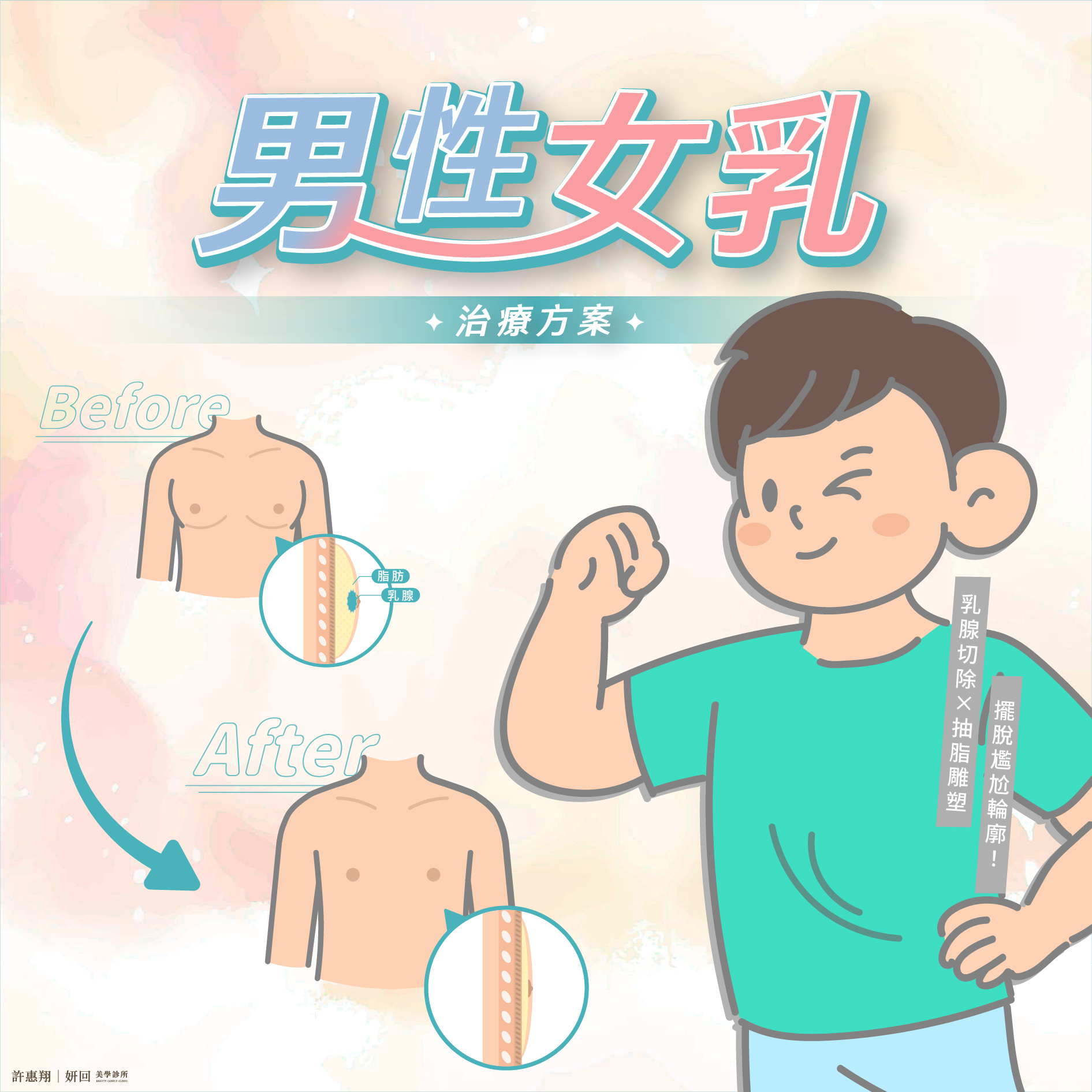男性女乳症手機版 BANNER